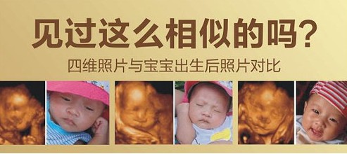 四维彩超：妈妈的“孕期高考” 选好“考场”很重要